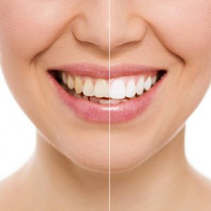 Dentist Epping